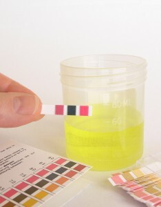 Hand holding strip of pH paper in front of specimen, with compar