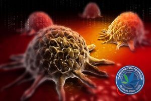bigstock-Cancer-cell-73911256-300x188