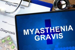 Diagnosis Myasthenia gravis and tablets.