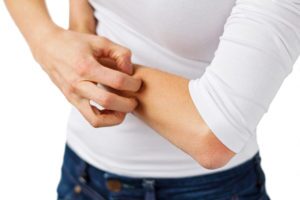 Eczema, dermatitis and itchy skin problem
