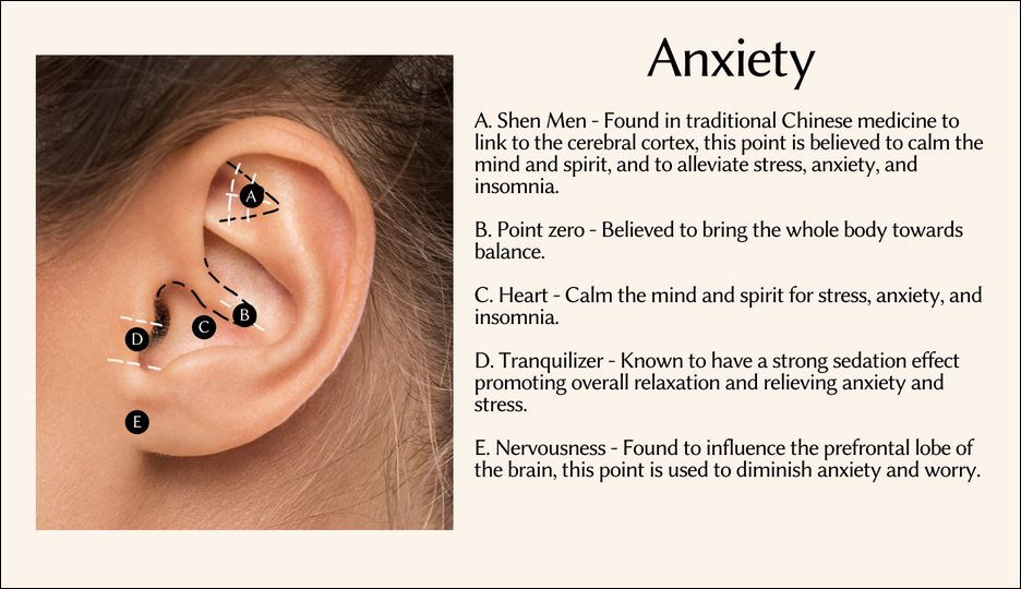 Anxiety Ear Seeds Image in Ear